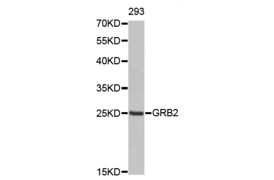 Western Blot - Anti-GRB2 Antibody (A0039) - Antibodies.com