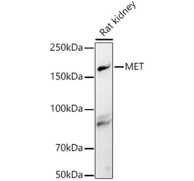 Western Blot - Anti-Met (c-Met) Antibody (A8341) - Antibodies.com