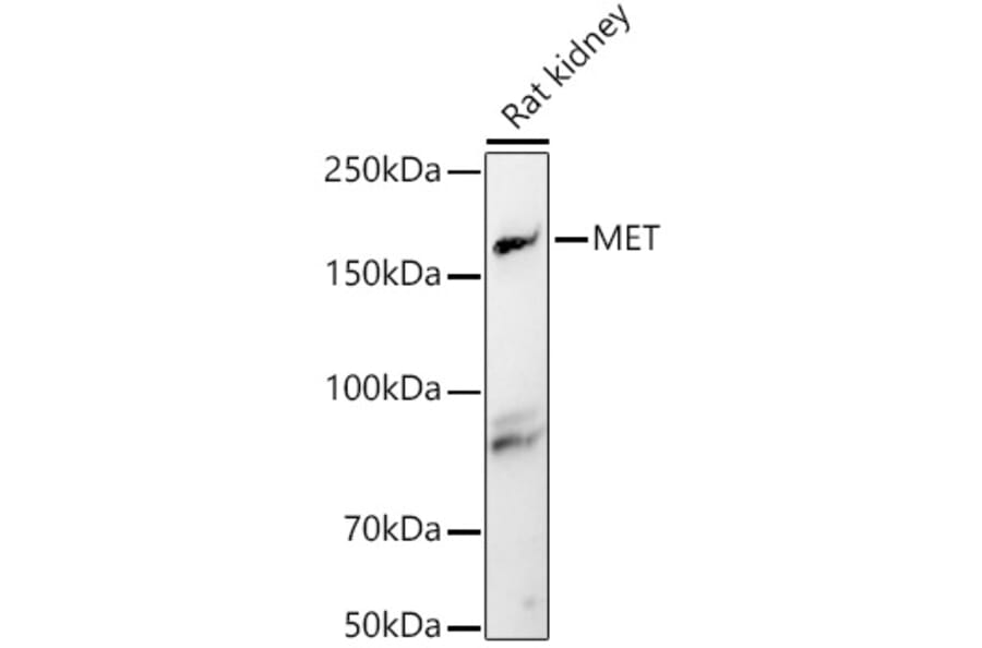 Western Blot - Anti-Met (c-Met) Antibody (A8341) - Antibodies.com