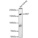 Western Blot - Anti-Met (c-Met) Antibody (A8341) - Antibodies.com