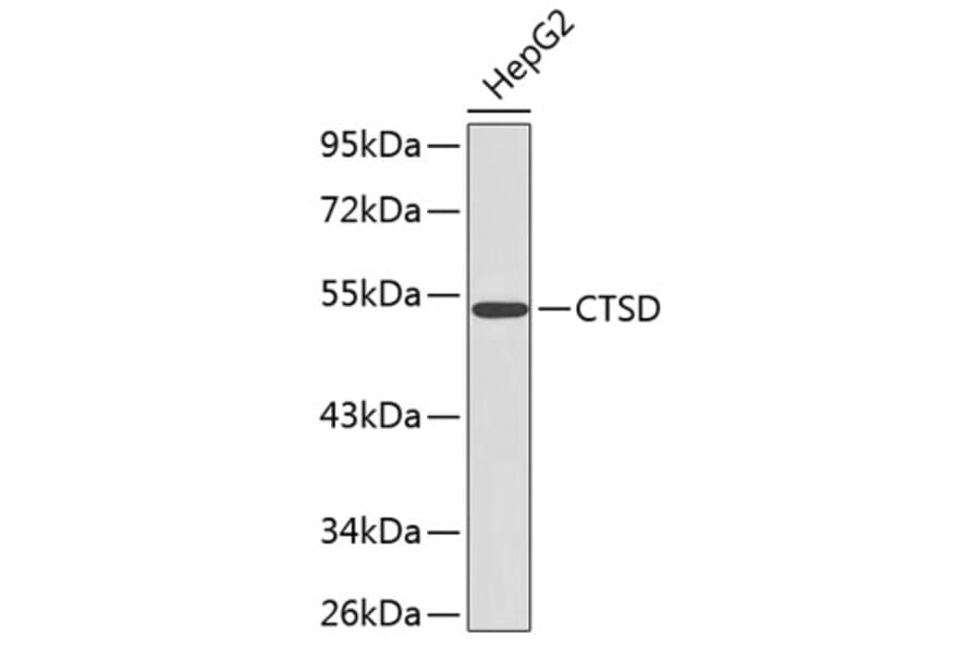 Western Blot - Anti-CTSD Antibody (A0041) - Antibodies.com