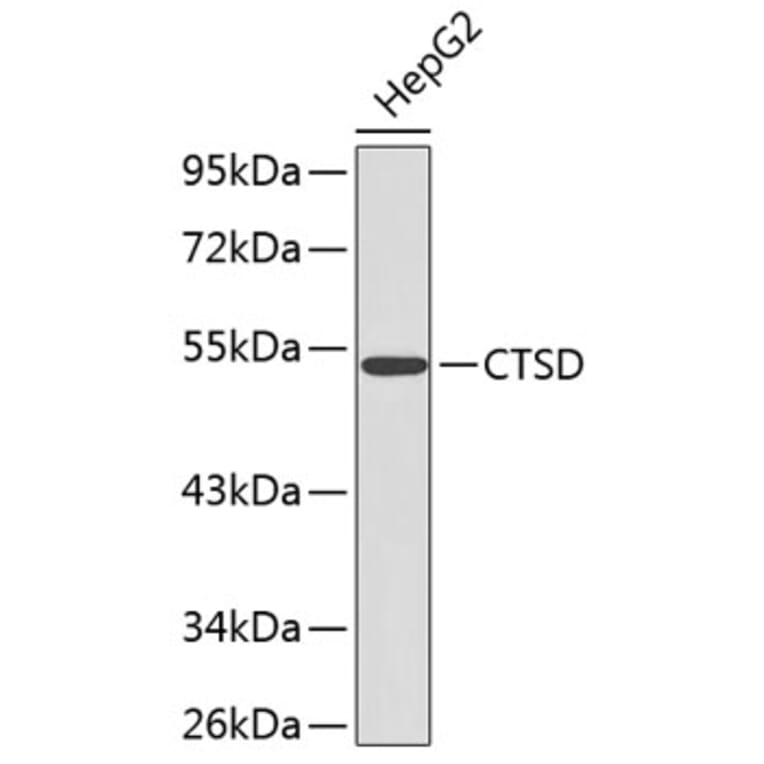Western Blot - Anti-CTSD Antibody (A0041) - Antibodies.com