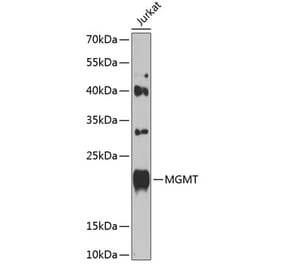 Western Blot - Anti-MGMT Antibody (A8345) - Antibodies.com
