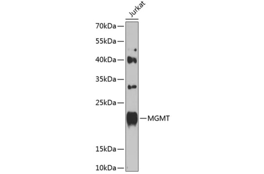 Western Blot - Anti-MGMT Antibody (A8345) - Antibodies.com