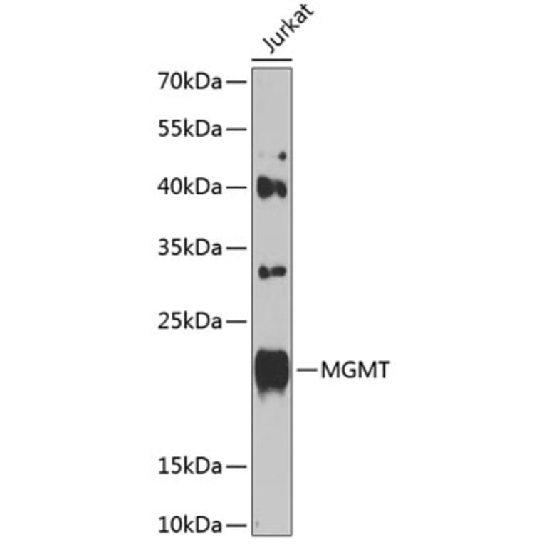 Western Blot - Anti-MGMT Antibody (A8345) - Antibodies.com