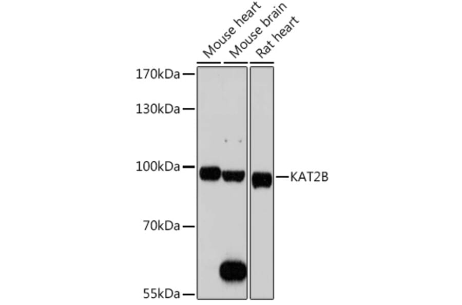 Western Blot - Anti-KAT2B/PCAF Antibody (A8349) - Antibodies.com