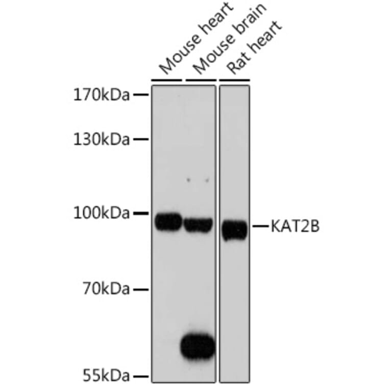 Western Blot - Anti-KAT2B/PCAF Antibody (A8349) - Antibodies.com