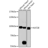 Western Blot - Anti-KAT2B/PCAF Antibody (A8349) - Antibodies.com