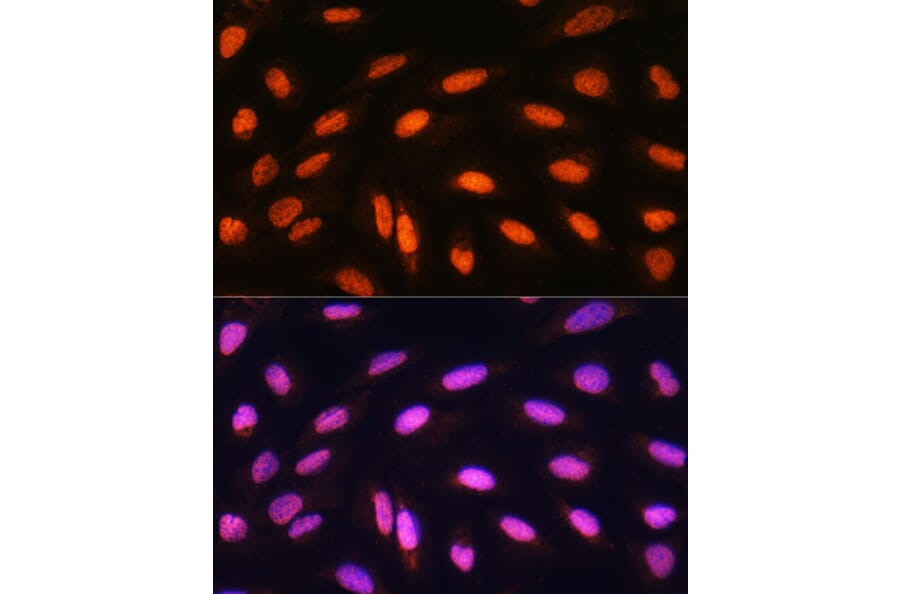 Immunofluorescence - Anti-KAT2B/PCAF Antibody (A8349) - Antibodies.com