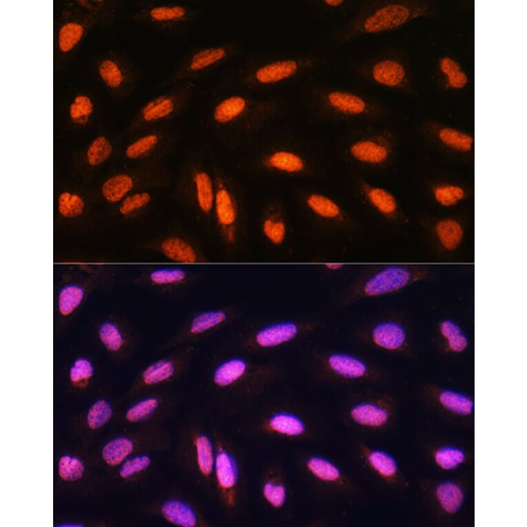Immunofluorescence - Anti-KAT2B/PCAF Antibody (A8349) - Antibodies.com