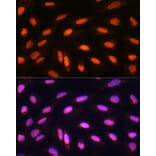 Immunofluorescence - Anti-KAT2B/PCAF Antibody (A8349) - Antibodies.com