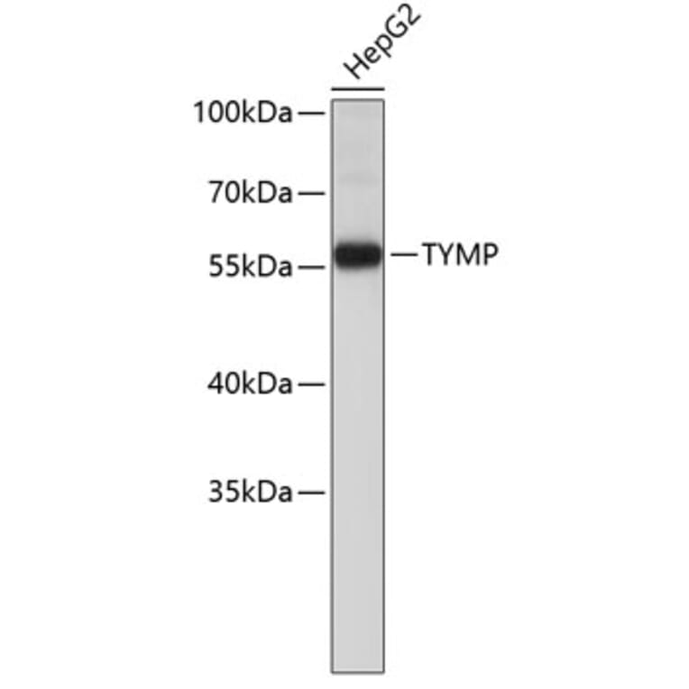 Western Blot - Anti-TYMP Antibody (A0070) - Antibodies.com