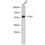 Western Blot - Anti-TYMP Antibody (A0070) - Antibodies.com