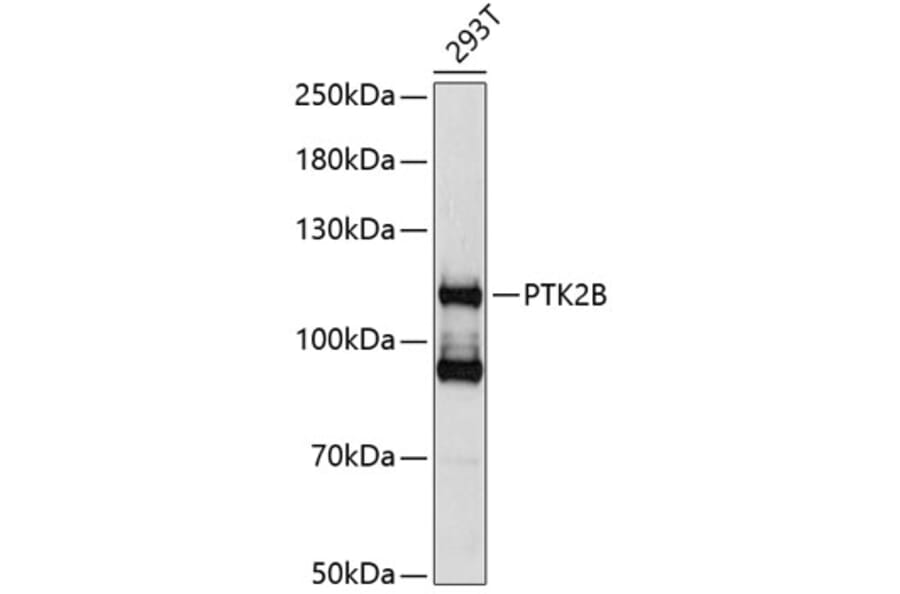 Western Blot - Anti-PTK2B Antibody (A0074) - Antibodies.com