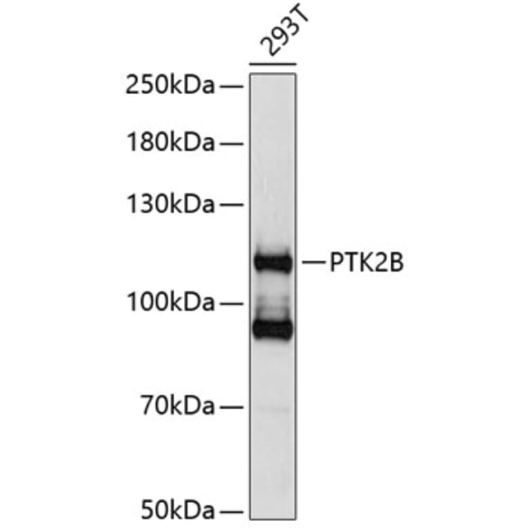 Western Blot - Anti-PTK2B Antibody (A0074) - Antibodies.com