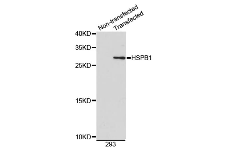 Western Blot - Anti-HSPB1 Antibody (A0090) - Antibodies.com