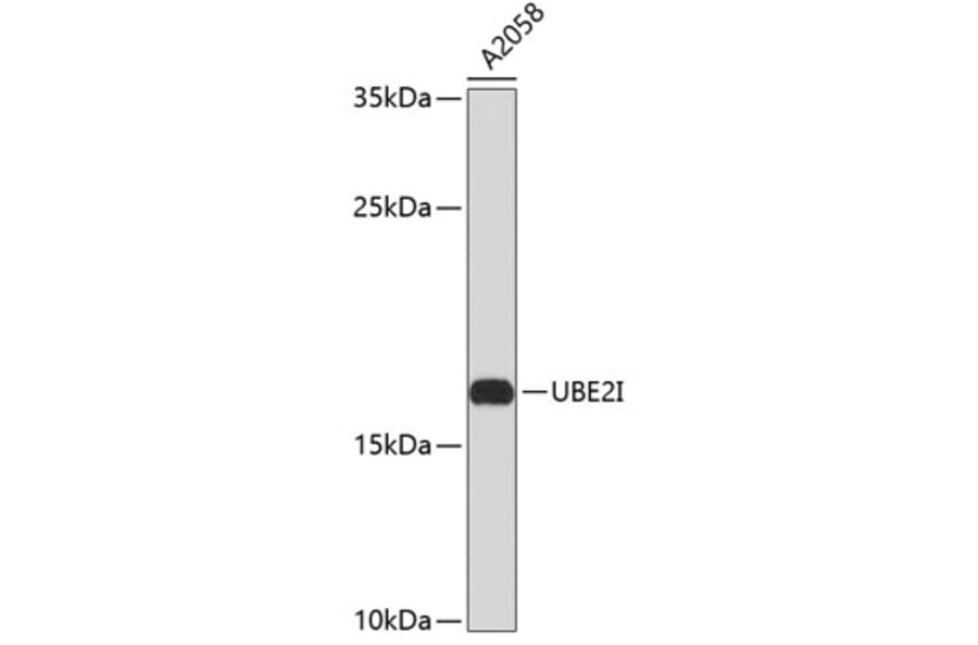 Western Blot - Anti-UBE2I Antibody (A0105) - Antibodies.com
