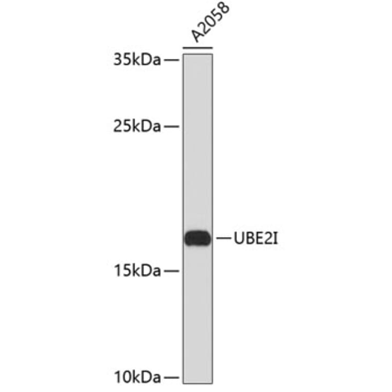 Western Blot - Anti-UBE2I Antibody (A0105) - Antibodies.com