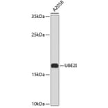 Western Blot - Anti-UBE2I Antibody (A0105) - Antibodies.com