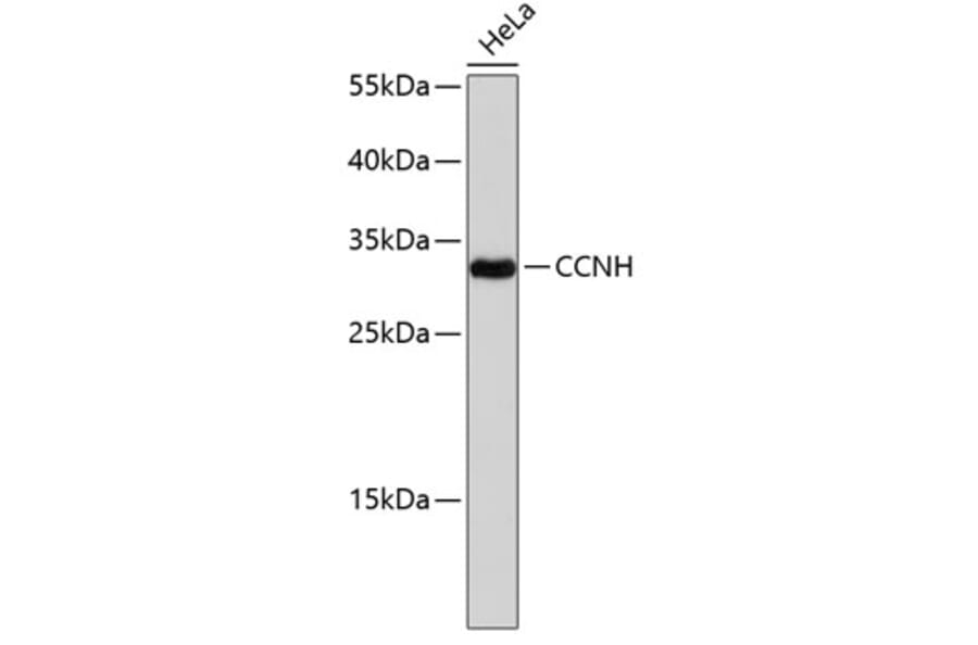 Western Blot - Anti-CCNH Antibody (A0107) - Antibodies.com