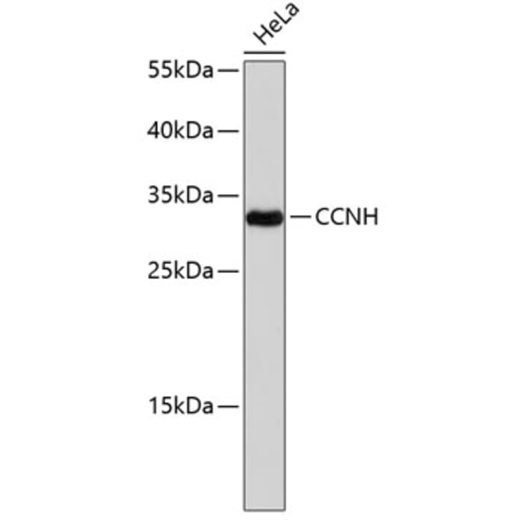 Western Blot - Anti-CCNH Antibody (A0107) - Antibodies.com