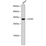 Western Blot - Anti-CCNH Antibody (A0107) - Antibodies.com
