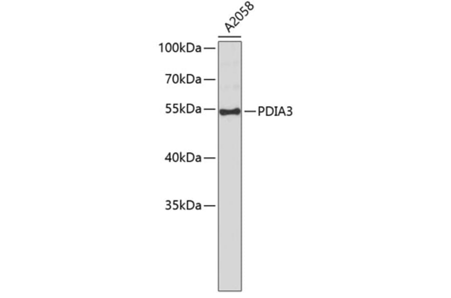 Western Blot - Anti-PDIA3 Antibody (A0117) - Antibodies.com