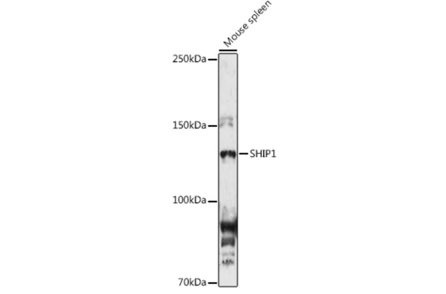 Western Blot - Anti-SHIP-1 Antibody (A8360) - Antibodies.com