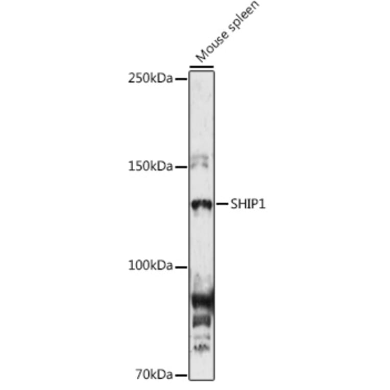 Western Blot - Anti-SHIP-1 Antibody (A8360) - Antibodies.com