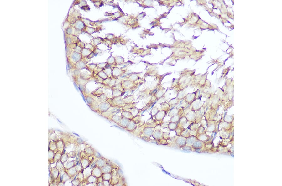 Immunohistochemistry - Anti-SHIP-1 Antibody (A8360) - Antibodies.com