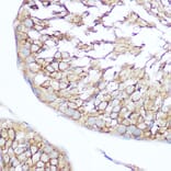 Immunohistochemistry - Anti-SHIP-1 Antibody (A8360) - Antibodies.com