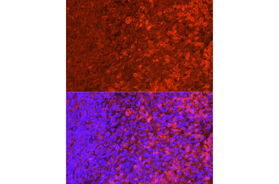 Immunofluorescence - Anti-SHIP-1 Antibody (A8360) - Antibodies.com