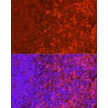 Immunofluorescence - Anti-SHIP-1 Antibody (A8360) - Antibodies.com