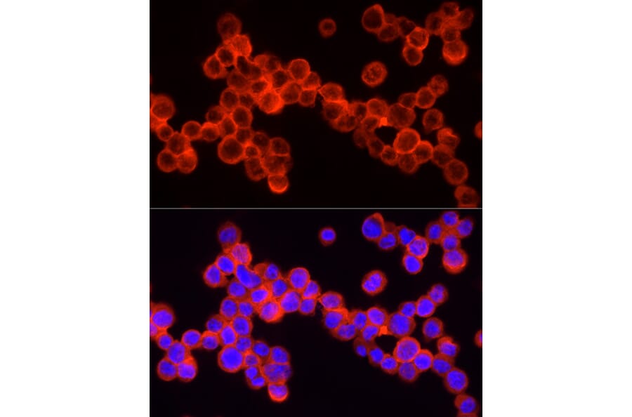 Immunofluorescence - Anti-SHIP-1 Antibody (A8360) - Antibodies.com