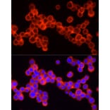 Immunofluorescence - Anti-SHIP-1 Antibody (A8360) - Antibodies.com