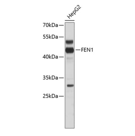 FEN1 Antibodies | Antibodies.com