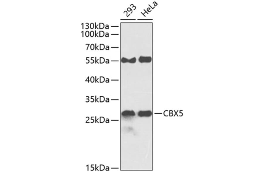 Western Blot - Anti-CBX5 Antibody (A0132) - Antibodies.com