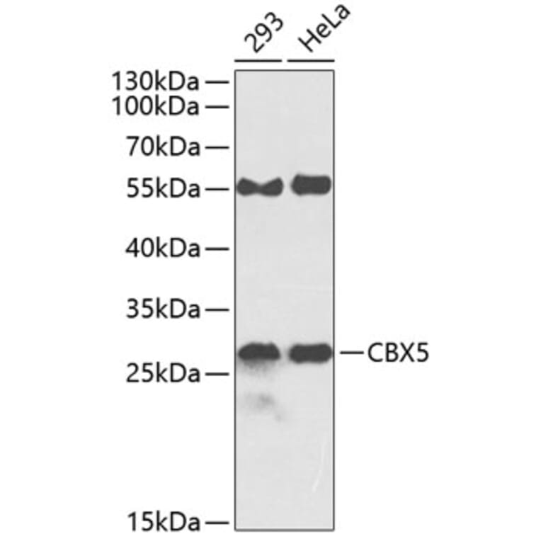 Western Blot - Anti-CBX5 Antibody (A0132) - Antibodies.com
