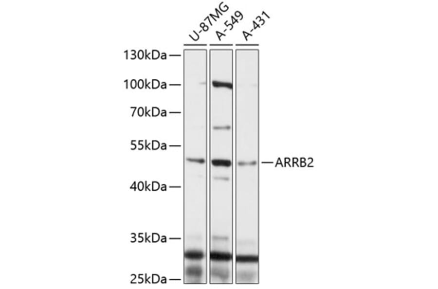 Western Blot - Anti-ARRB2 Antibody (A0142) - Antibodies.com
