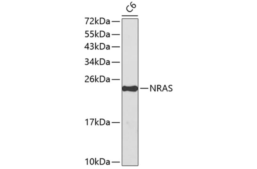 Western Blot - Anti-NRAS Antibody (A0155) - Antibodies.com