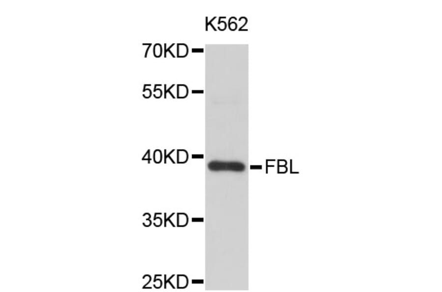 Western Blot - Anti-FBL Antibody (A0158) - Antibodies.com