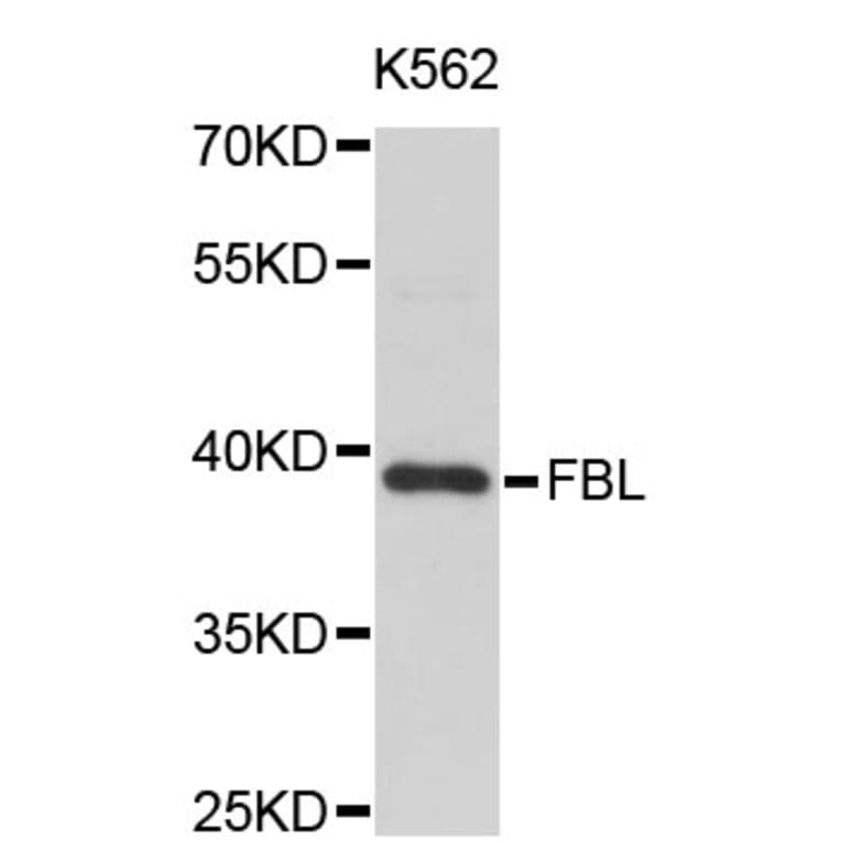 Western Blot - Anti-FBL Antibody (A0158) - Antibodies.com