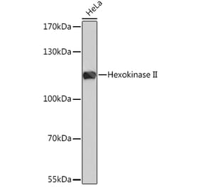 Western Blot - Anti-Hexokinase II Antibody (A8368) - Antibodies.com