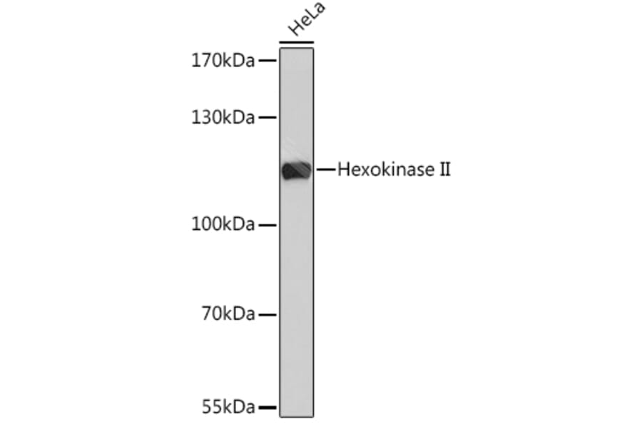 Western Blot - Anti-Hexokinase II Antibody (A8368) - Antibodies.com