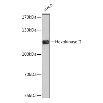 Western Blot - Anti-Hexokinase II Antibody (A8368) - Antibodies.com