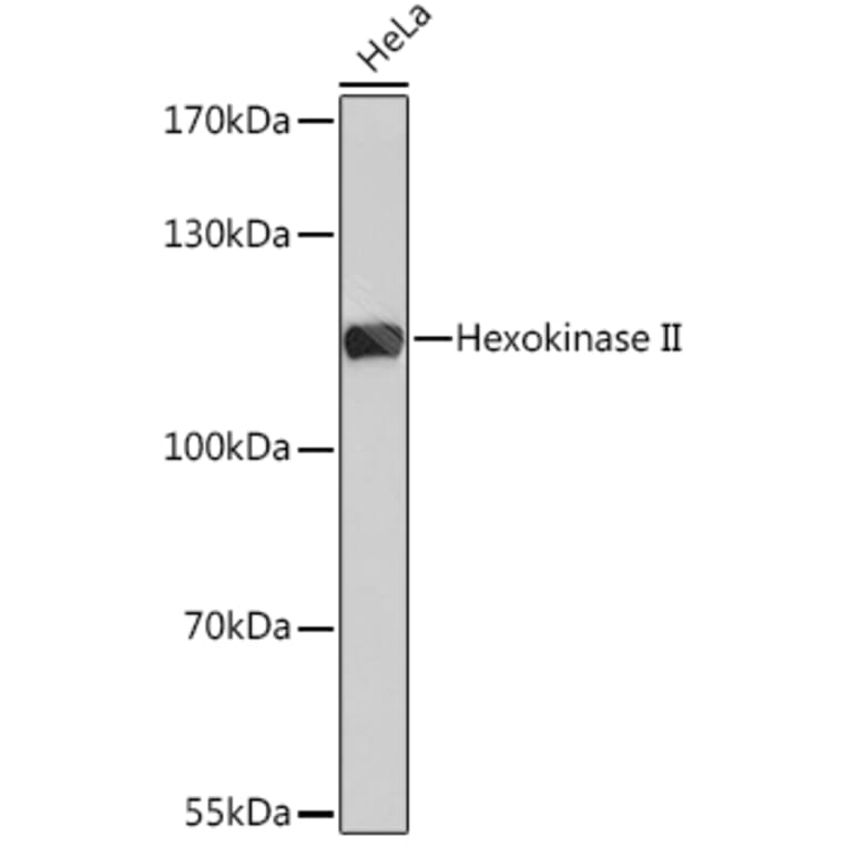 Western Blot - Anti-Hexokinase II Antibody (A8368) - Antibodies.com