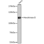 Western Blot - Anti-Hexokinase II Antibody (A8368) - Antibodies.com