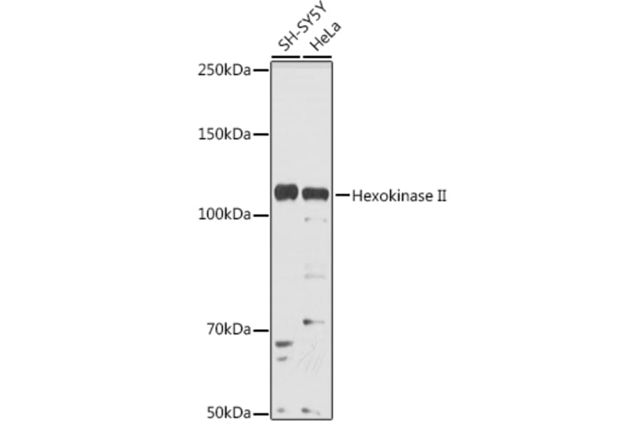 Western Blot - Anti-Hexokinase II Antibody (A8368) - Antibodies.com