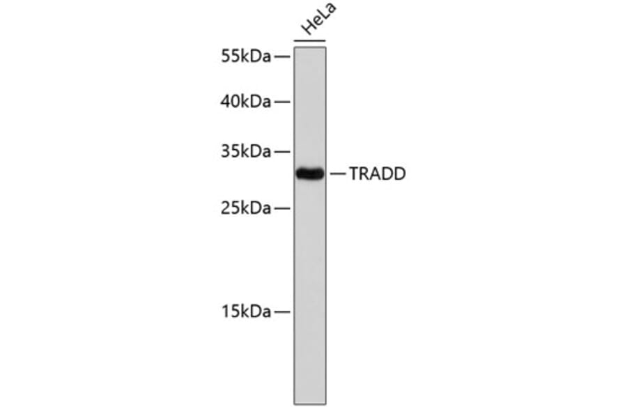 Western Blot - Anti-TRADD Antibody (A0183) - Antibodies.com