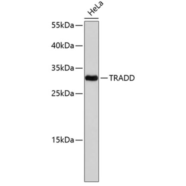 Western Blot - Anti-TRADD Antibody (A0183) - Antibodies.com